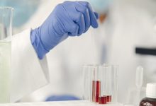 Fentanyl test